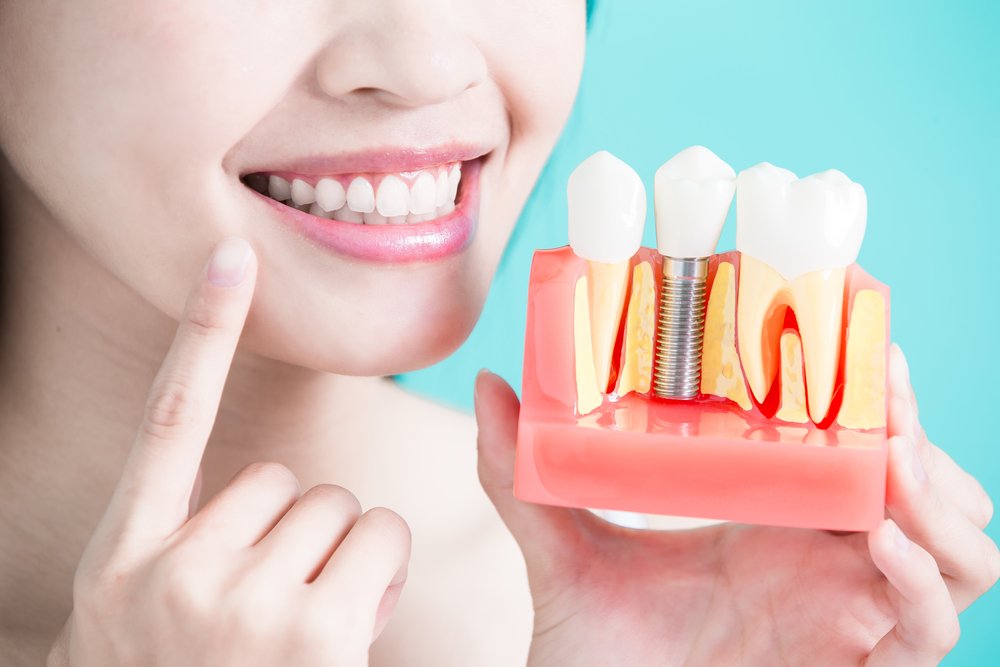 dental-implants-treatment