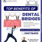 Benefits of Dental Bridges | Royale Dental Clinic & Research Centre