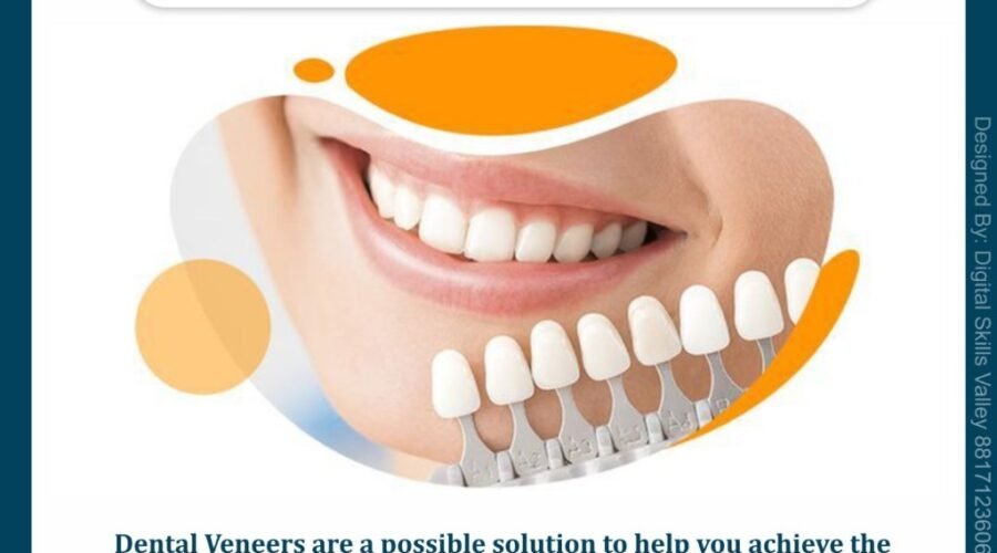 Dental Veneers | Royale Dental Clinic