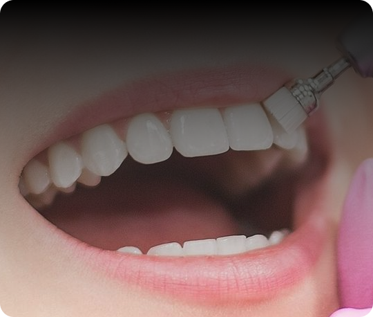 Dental cleaning in progress