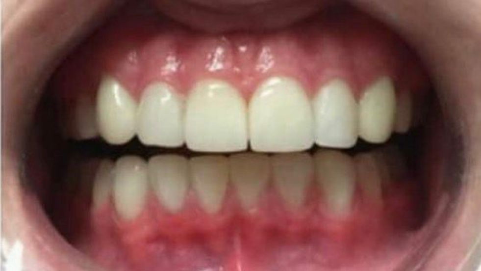 Healthy white teeth with clean alignment and pink gums, showing good oral hygiene and strong dental health.